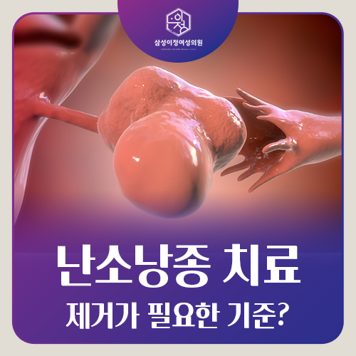 난소낭종, 꼭 수술해야 할까?