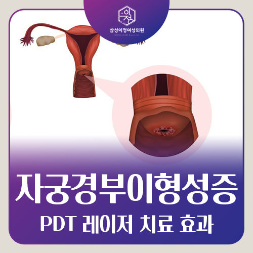 HPV 양성 판정을 받았다면 어떻게 관리해야 할까요?